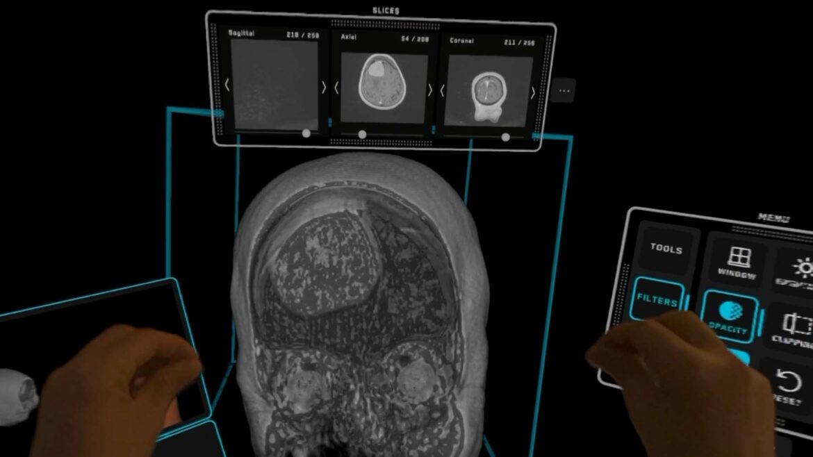 Mixed Reality in Medicine: Innovations for Surgery